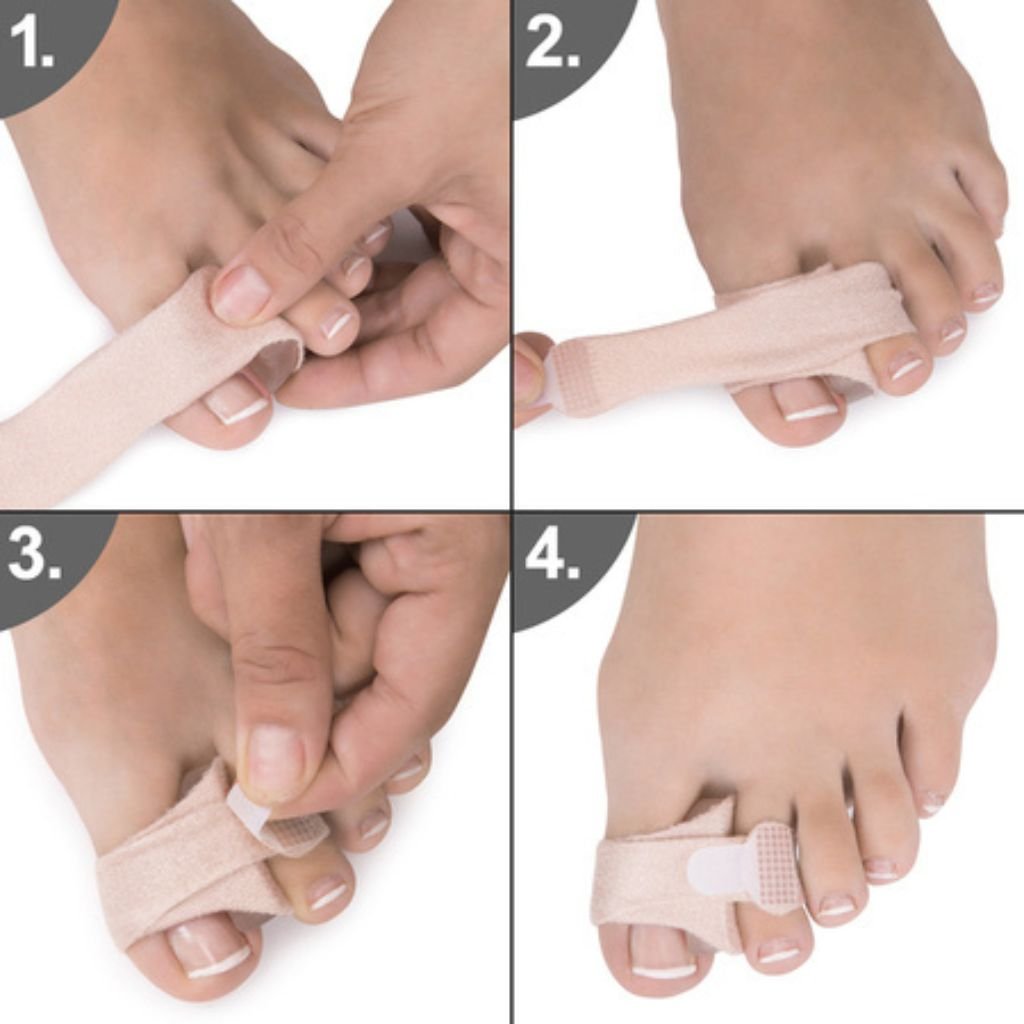 Nasadenie korektora Fix & Correct na prsty